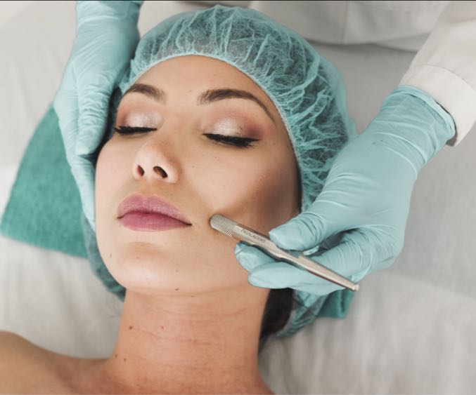 Featured image for post: All About Micro Dermabrasion